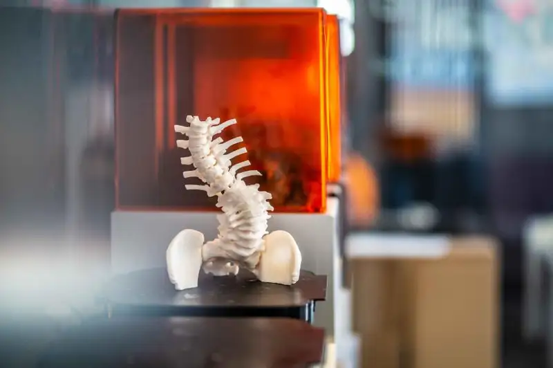 Otandyq medıtsınada 3D prınterler paıda bolmaq