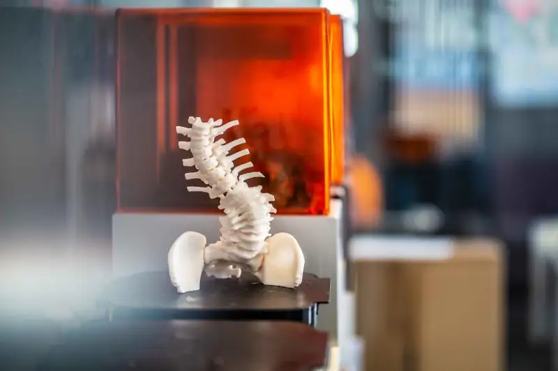 Қозоғистон тиббиётида 3D принтерлар қўлланилиши мумкин