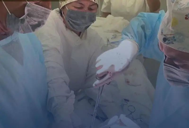 Tarazda 12 jasar qyzdyń asqazanynan 1 keliden astam shash alyndy