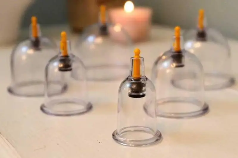 Лечение младенца хиджамой - центр закроют в Атырау