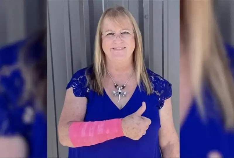 Жительница Техаса серьезно пострадала после того, как на нее с неба упала змея и атаковал ястреб