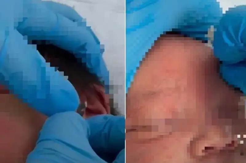 Нанесения лезвием надрезов ребенку в центре «Рабиға хиджама» расследовали в Атырау