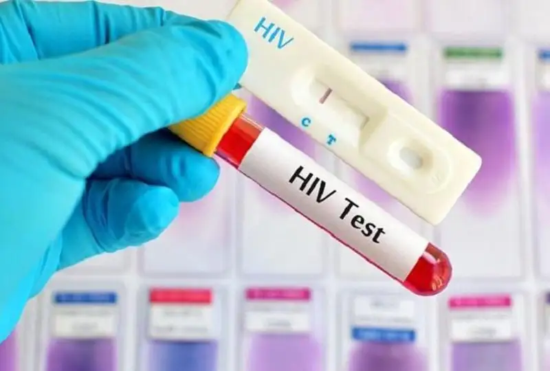 В США создали генную терапию, уничтожающую ВИЧ