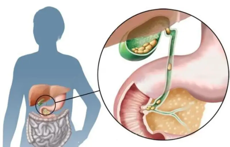 ءوت جولدارىن قالاي ەمدەۋگە بولادى؟ - دارىگەر جاۋاپ بەردى