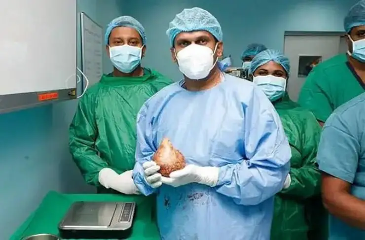 دارىگەرلەر ەر ادامنىڭ بۇيرەگىنەن تاريحتاعى ەڭ ۇلكەن تاستى الىپ تاستادى