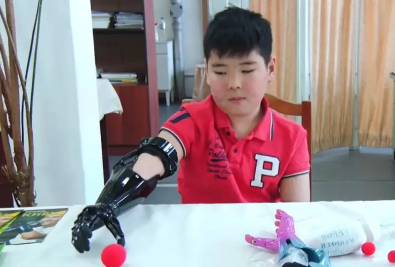 Первый протез кисти руки «Киби» для детей изготовлен в Кыргызстане