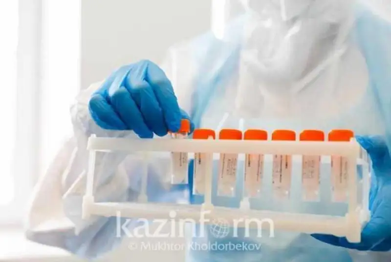 Álemde koronavırýsqa 761 mln adam shaldyqty – DDSU