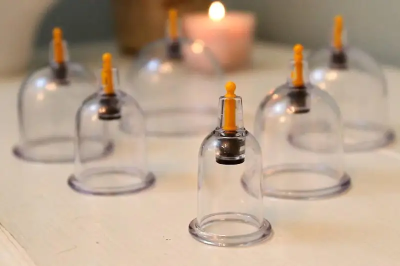 По факту лечения хиджамой младенца в Атырау будет проведена проверка