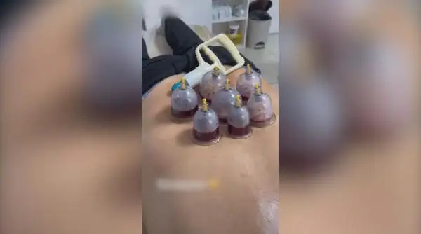 ەلىمىزدە حيدجاما جاسايتىندارعا ليتسەنزيا بەرىلمەيدى
