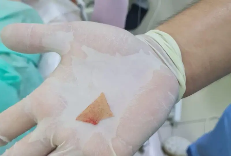 الماتى وبلىسىنىڭ دارىگەرلەرى وڭەشىنە سۇيەك تۇرىپ قالعان ايەلدى امان الىپ قالدى