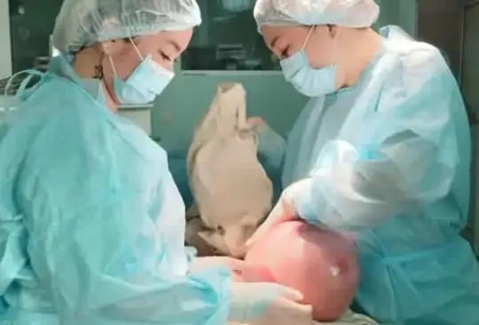 Операцию по удалению гигантской миомы провели в Атырау