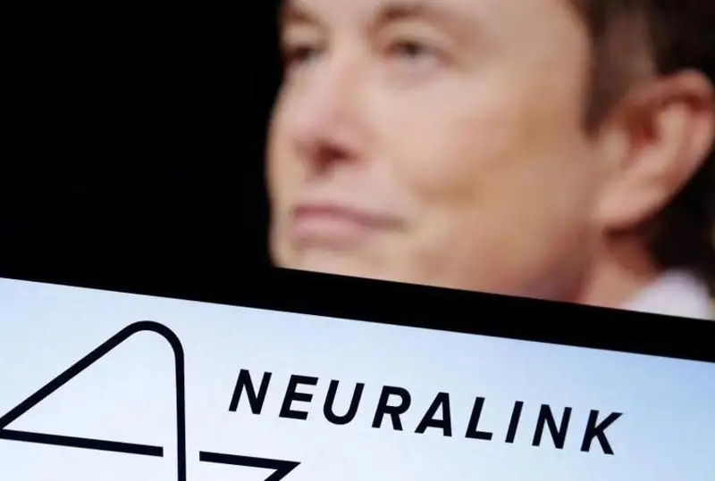 Илон Маскнинг компанияси инсон миясига микрочип ўрнатишга рухсат олди