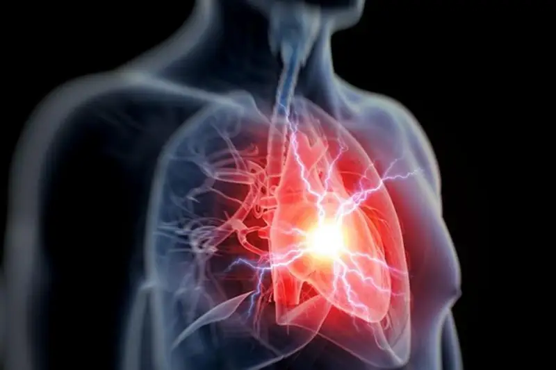 Назван день, когда случается больше всего инфарктов