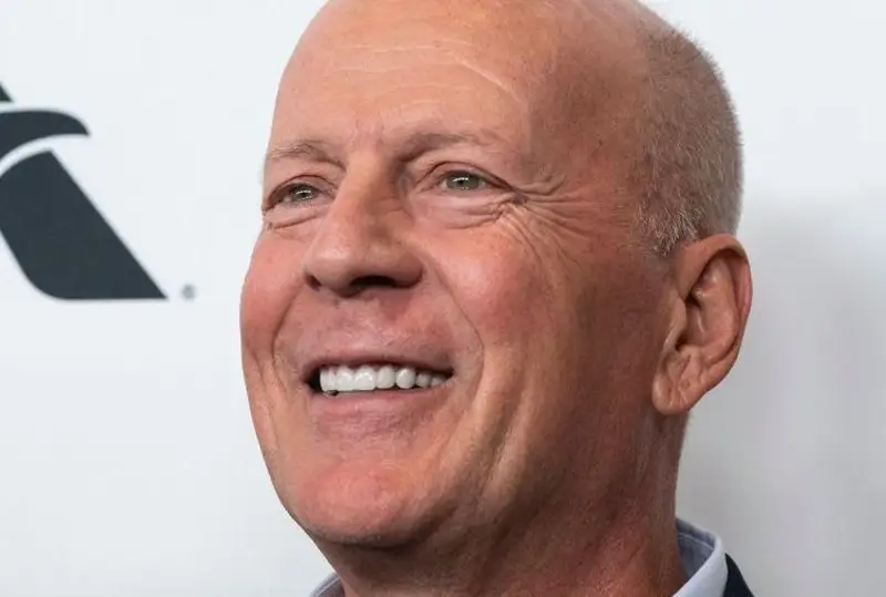 Брюс Уиллиснинг оиласи актёр ақлий заифликка чалинганини  маълум қилди