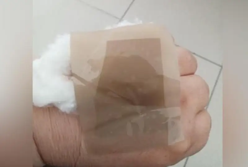 Лейкопластырь орнына скотч: Ақтөбе облысының Денсаулық басқармасы түсінік берді