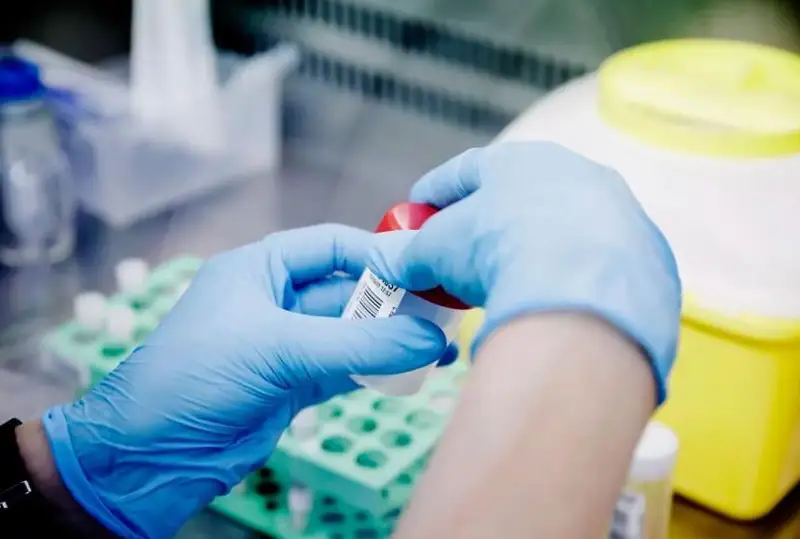 Маймун чечаги дунёнинг 27 та давлатида аниқланган