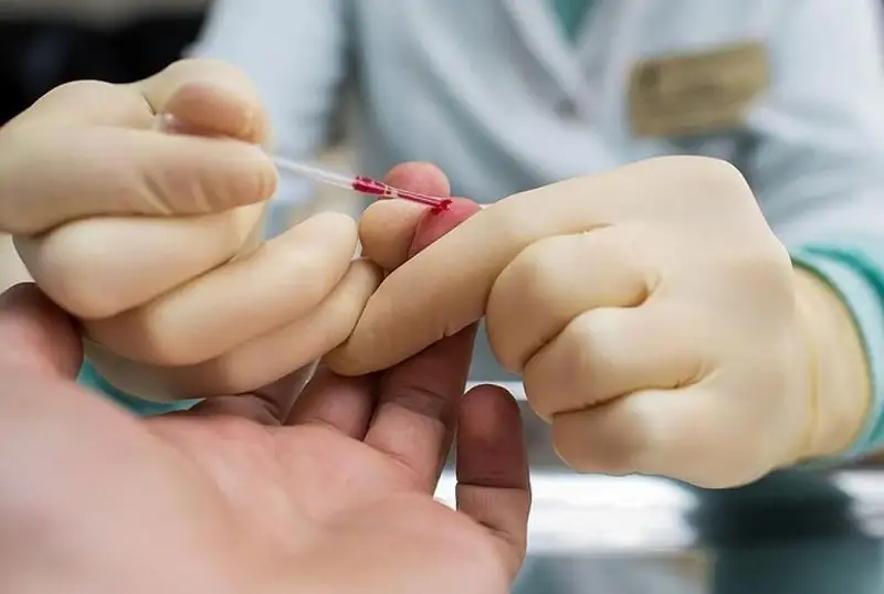 اتىراۋ وبلىسىندا بيىل قاۋىپتى ا ي ت ۆ ينفەكسياسىن جۇقتىرۋ 1,8 ەسە وسكەن