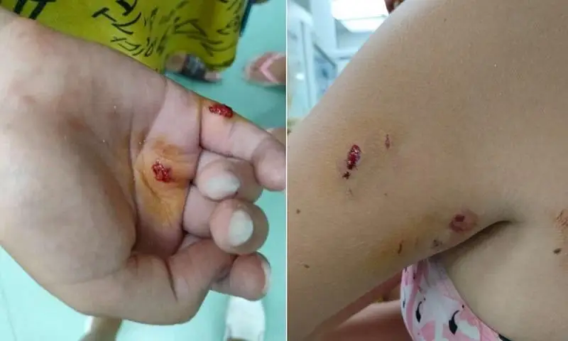 Тюлень напал на детей в Актау