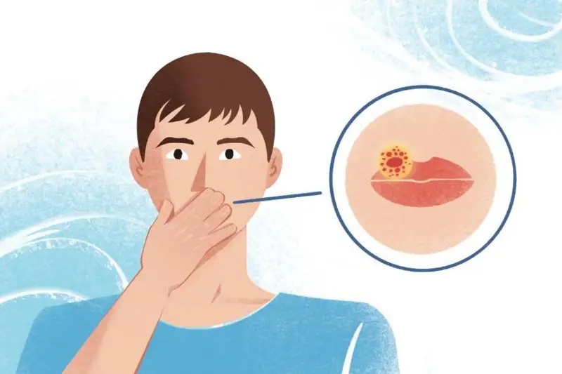 ۇشىقتىڭ ادامدارعا جۇعاتىنى راس پا؟