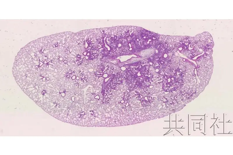 日本研究团队探明人造微粒引发肺部炎症机制