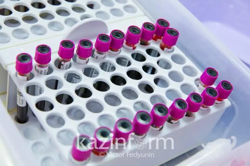 Коронавирус бўйича дунёдаги вазият