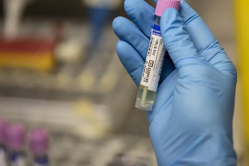 Почти 3 тыс. случаев оспы обезьян в США – эксперты здравоохранения бьют тревогу