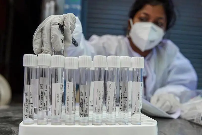 Ҳиндистонда СOVID-19ни юқтирганлар сони 3 миллиондан ошди