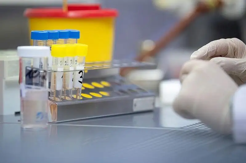 Қирғизистонда коронавирус туфайли илк ўлим ҳолати қайд этилди