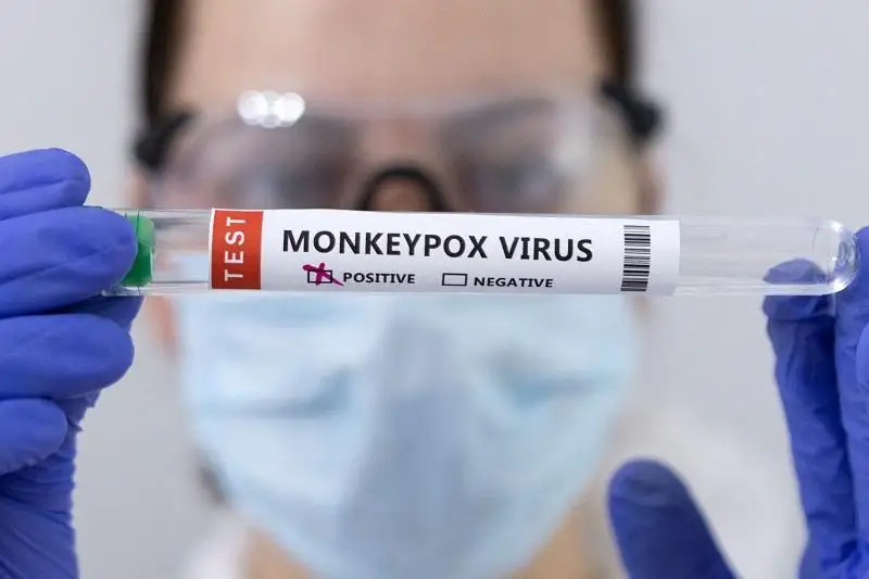 研究发现少数男性猴痘患者精液中含猴痘DNA
