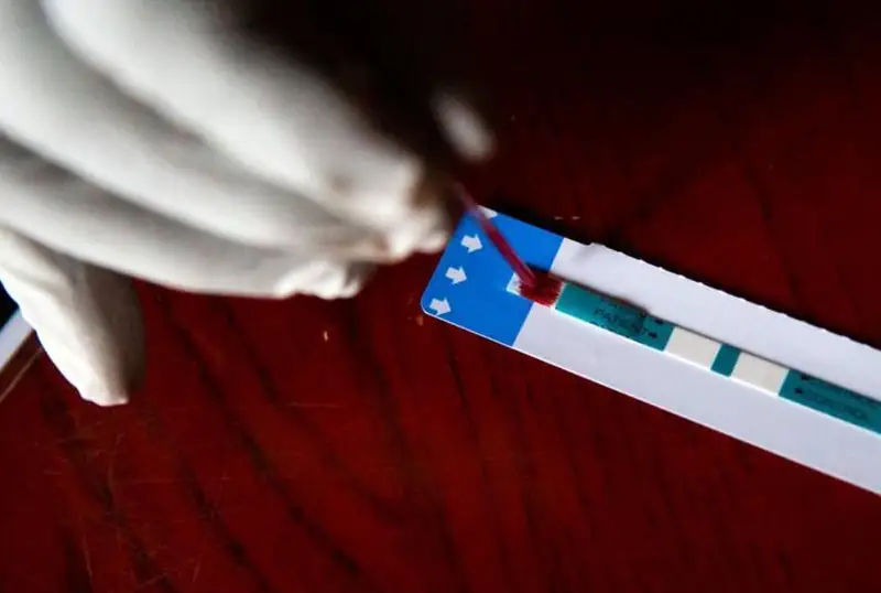 ЖССТ ОИВ инфекциясини олдини олувчи янги дори воситасидан фойдаланишни тавсия қилди