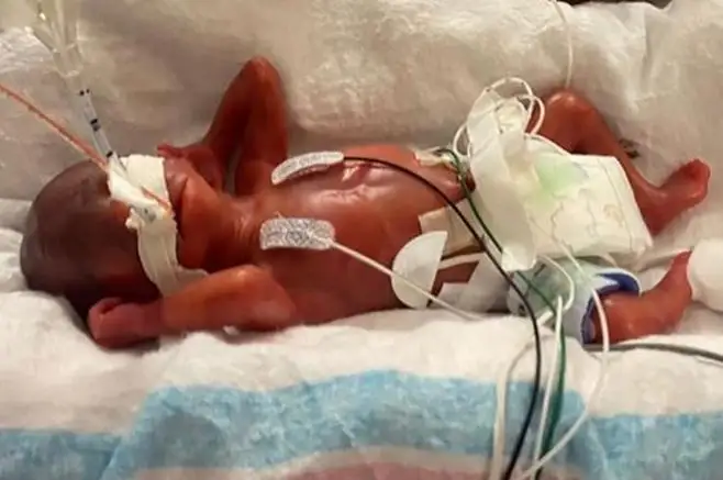 Тарихдаги энг эрта туғилиш AҚШда қайд этилди