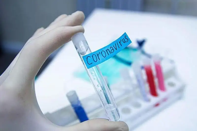 Дунёда коронавирус инфекциясини юқтирганлар сони 531 750 882 нафарга етди