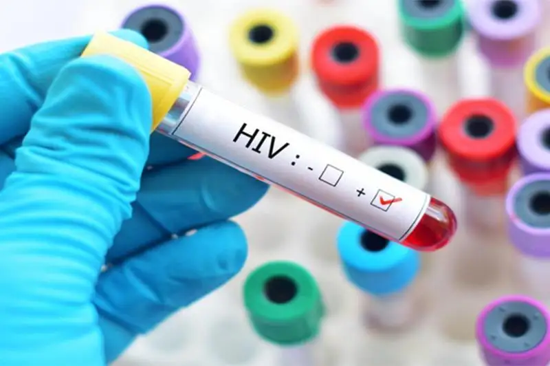 荷兰发现毒力和传染性更强HIV变体