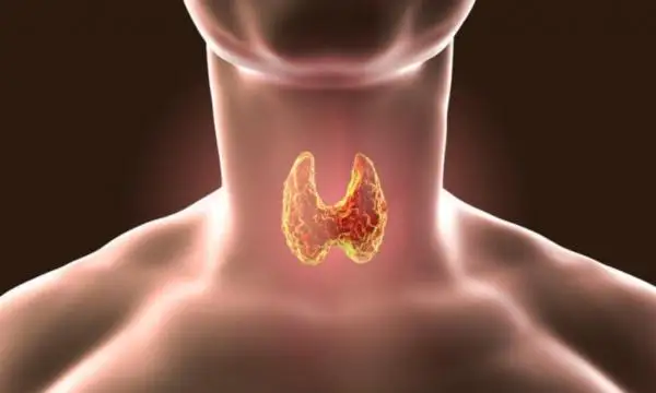 قالقانشا بەزى جۇمىسىنىڭ بۇزىلۋى: ونىڭ سالدارى مەن الدىن الۋ
