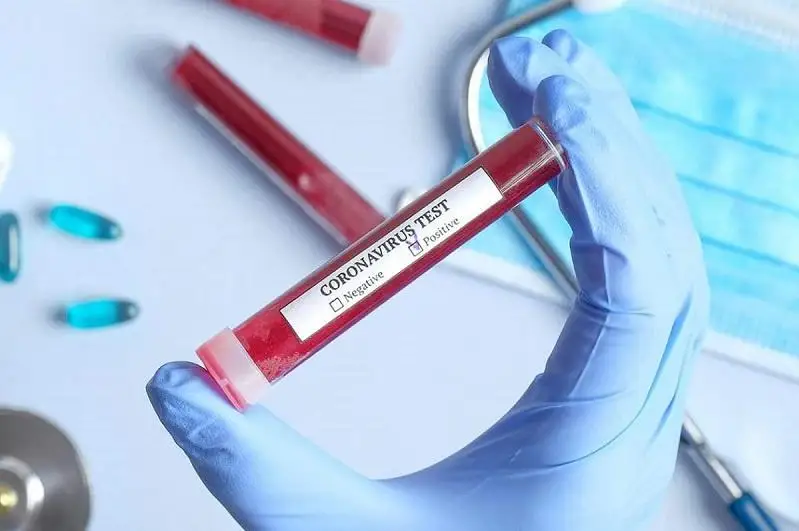 Ўзбекистонда коронавирусга чалинганлар сони 64 мингдан ошди– ССВ