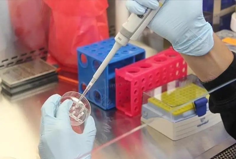 70 дан ортиқ мамлакат маймун чечагидан азият чеккан - ЖССТ