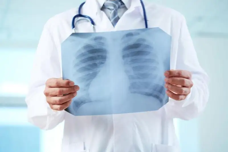 Пятнадцать казахстанцев заболели пневмонией за сутки