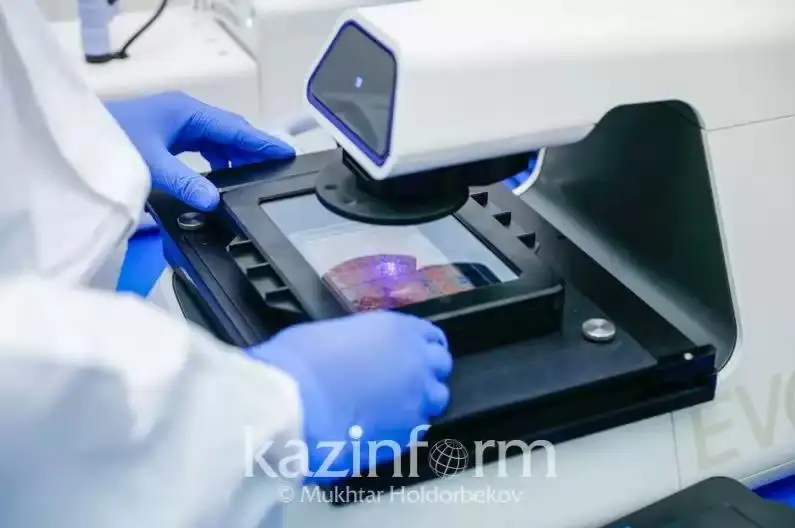 Исроиллик олимлар кариес пайдо бўлишининг олдини олувчи молекулани топдилар