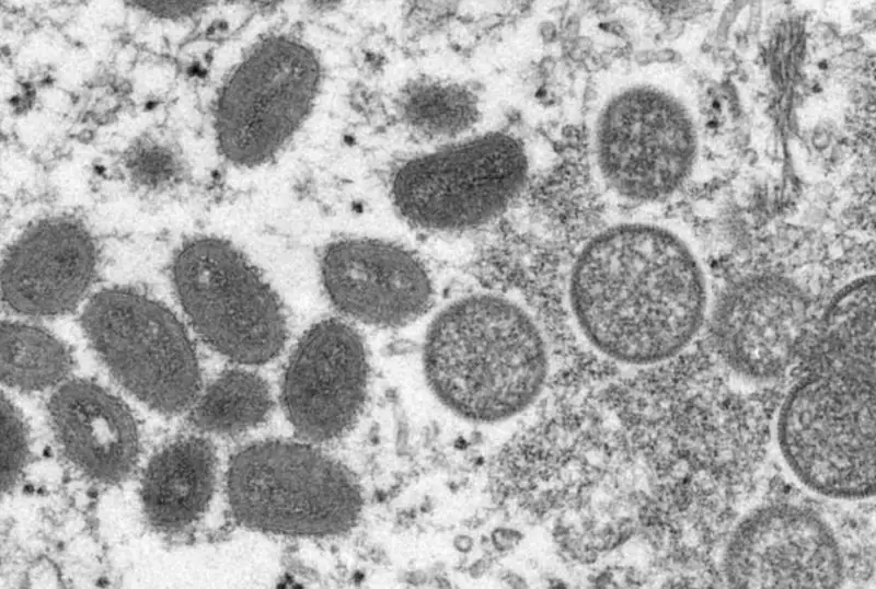 Японияда маймун чечагининг биринчи ҳолати қайд этилди