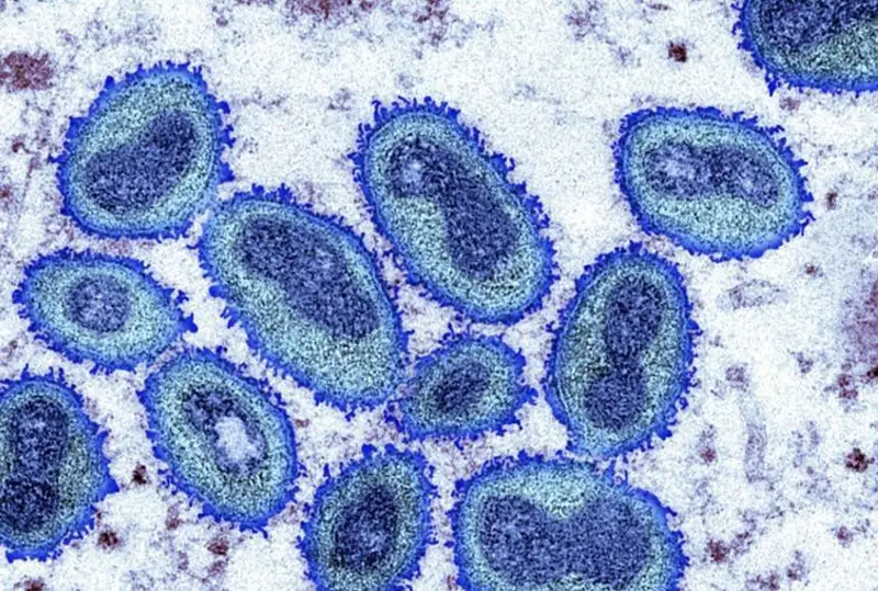 Уч ҳафтада Африкадан ташқарида маймун чечагини 780 зиёд одам юқтирди