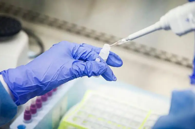 АҚШда «Омикрон» штамми билан касалланиш кўрсатгичи бир ҳафтада 8-10% дан 73% гача кўтарилди