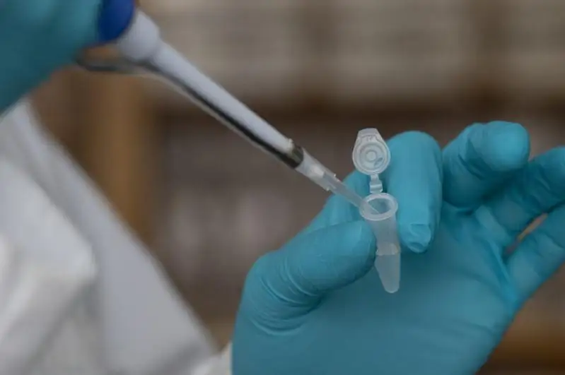 АҚШда CОVID-19 ва унинг вариантларини самарали равишда зарарсизлантириш учун янги антитана топилди