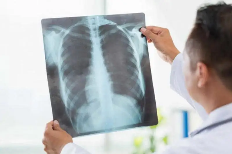 Два казахстанца заболели пневмонией за сутки