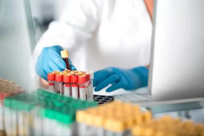 Боливияда 15 одам маймунчечак юқтиргани тасдиқланди