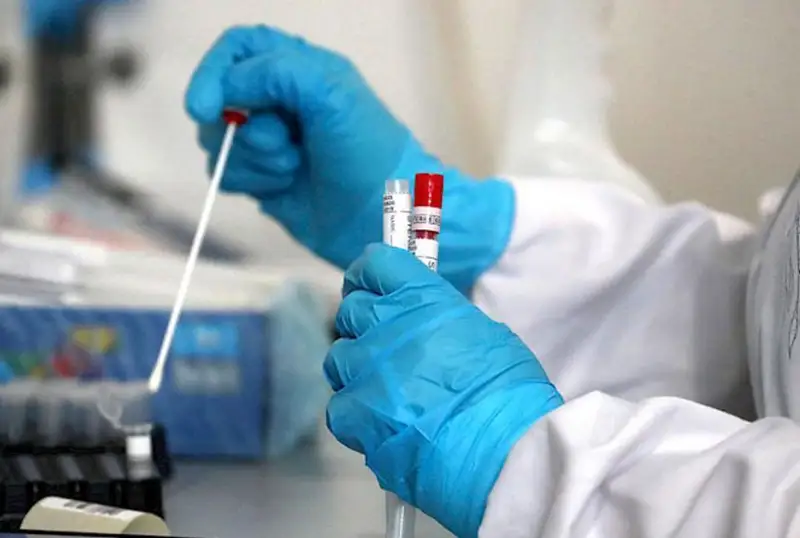 Ўтган ҳафтада дунёда 5,8 миллиондан ортиқ одам коронавирус билан касалланган