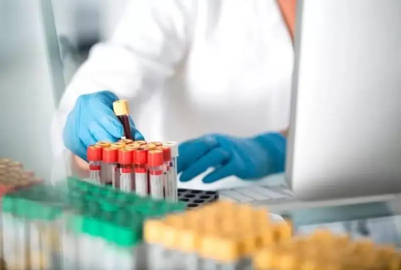 Бельгияда маймун чечагидан ўлимнинг биринчи ҳолати қайд этилди