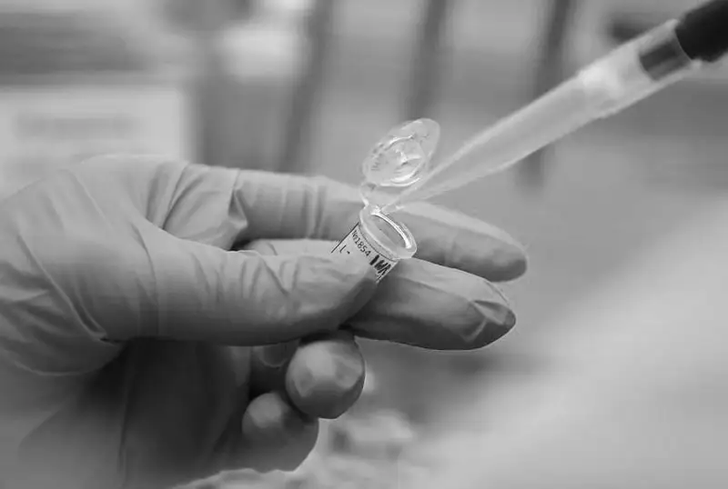 АҚШда иккинчи одам маймун чечагидан вафот этди