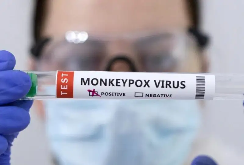 Боливия подтвердила 15 случаев заражения оспой обезьян