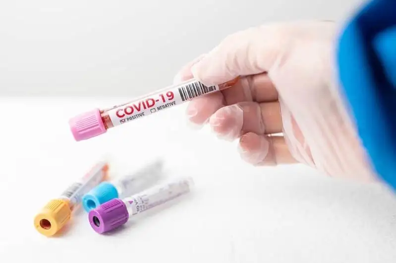 Aнтирекорд: Грецияда бир кунда  7335 кишида коронавирус аниқланган