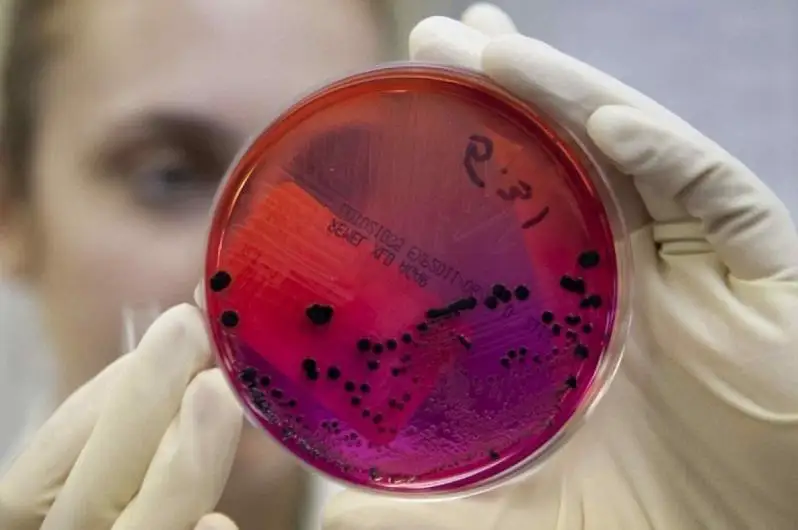 SARS-CоV-2 вируси пандемия бошланганидан буён бутун дунё бўйлаб 219 миллиондан ортиқ одамда аниқланган